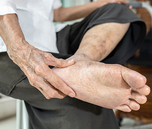 heel pain